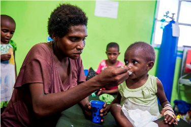 Penyebab Kurang Gizi di Asmat Mulai Terungkap