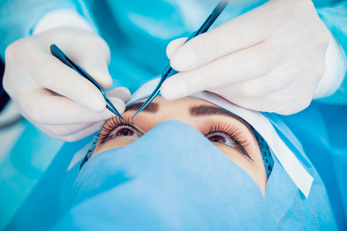 Penanganan pada Kedua Mata yang Terkena Katarak