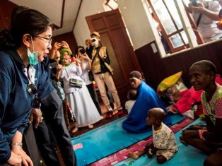 Penanganan Gizi Buruk Asmat Jadi Percontohan