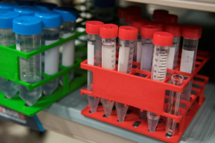 Japan to Trial 'World's First Urine Test' to Spot Cancer