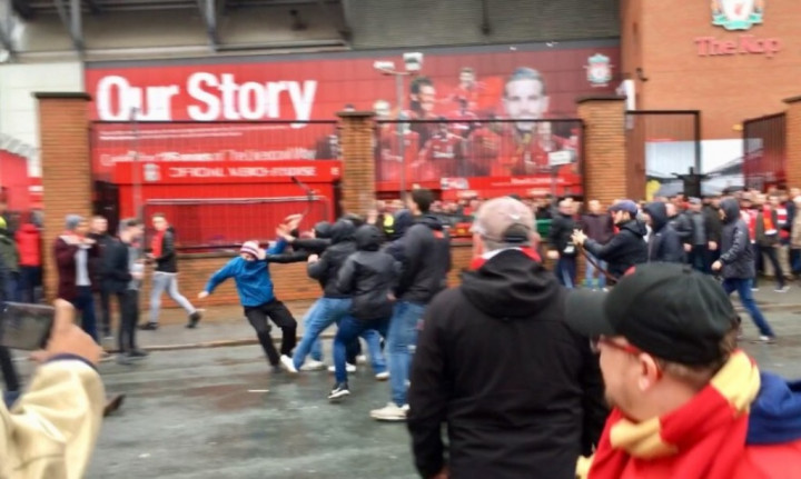 Jadi Korban Pemukulan, Kondisi Suporter Liverpool Kritis