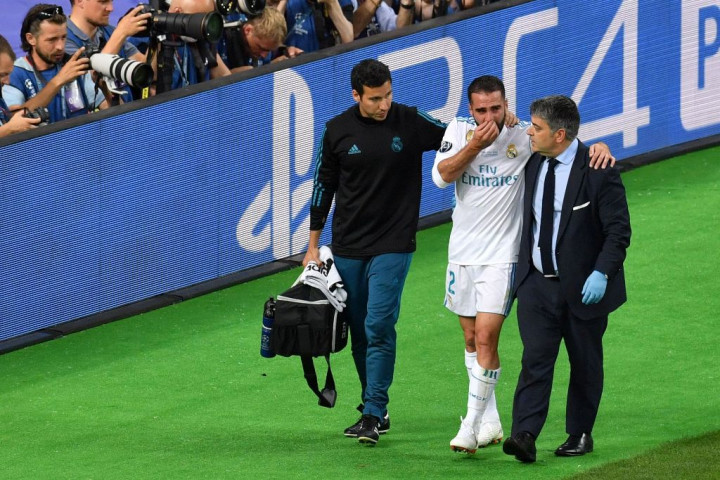 Carvajal Terancam Absen di Piala Dunia 2018