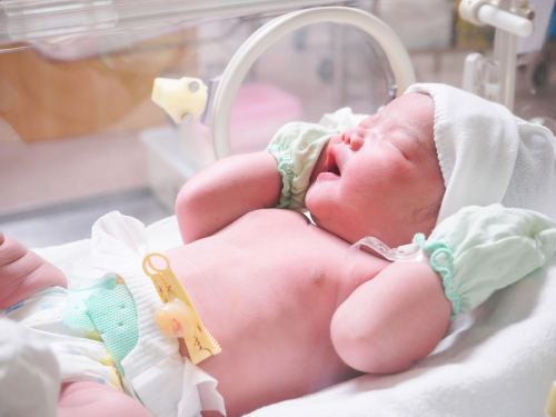 Tips Merawat Bayi  Prematur 