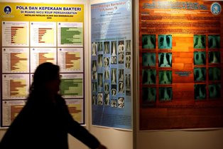 TBC Tidak hanya Serang Paru-paru