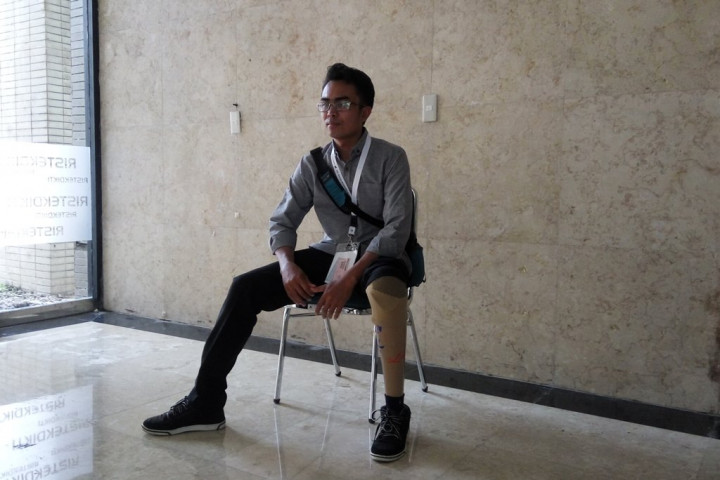 Terinspirasi Tom and Jerry, Pemuda Ini Bikin Kaki Palsu dari Serat Kelapa