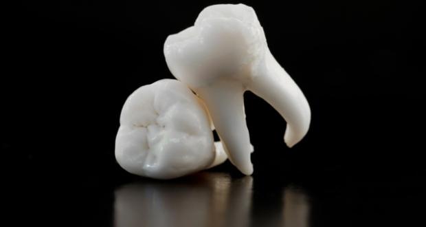 Studi: Masalah Gigi Picu Kekurangan Gizi pada Lansia