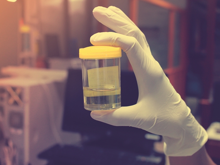 Masyarakat Diajak Saling Edukasi Bahaya Rebusan Pembalut