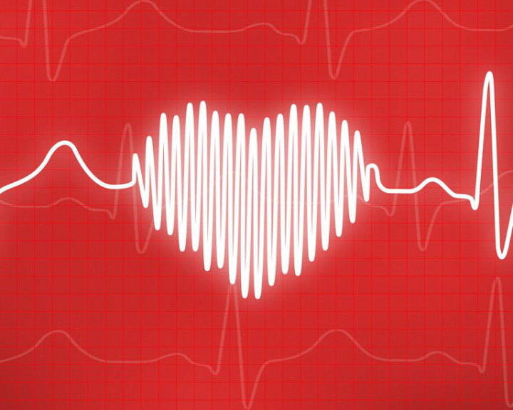 Kram Kaki Bisa Jadi Faktor Penyebab Serangan Jantung