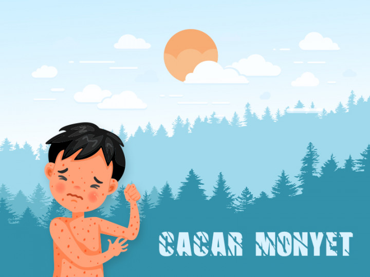 KLB (Kejadian Luar Biasa) Cacar Monyet