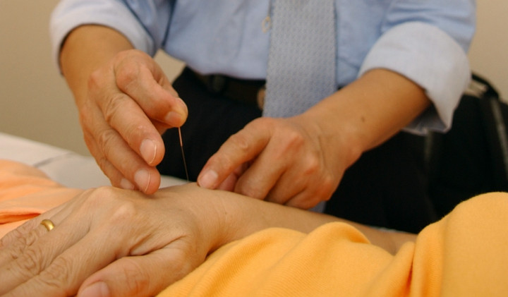 Manfaat Akupunktur bagi Kesehatan Mental