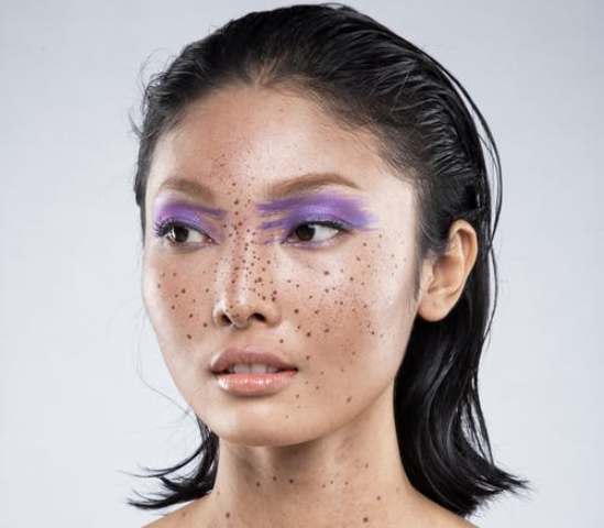 Tips Mudah Mengatasi Jerawat dengan Cepat