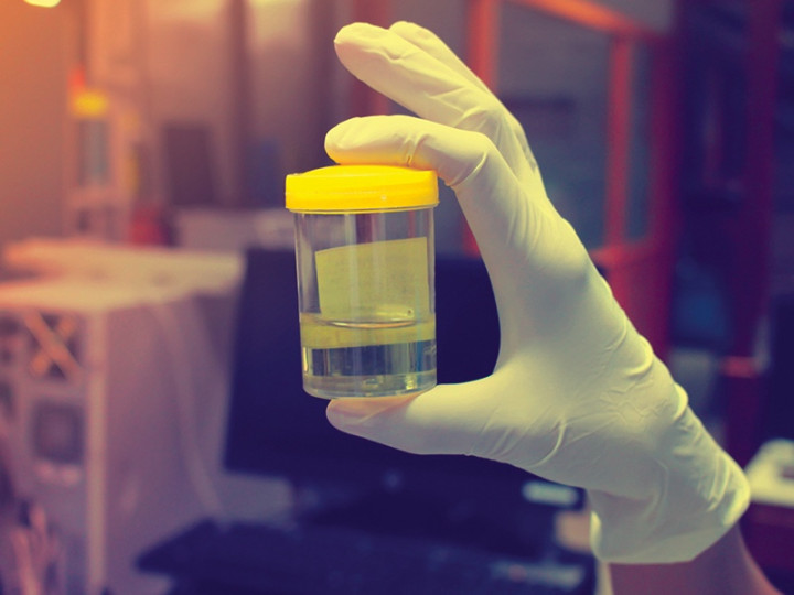 Hindari Percikan Air Kencing, Empat Wisatawan Dirawat