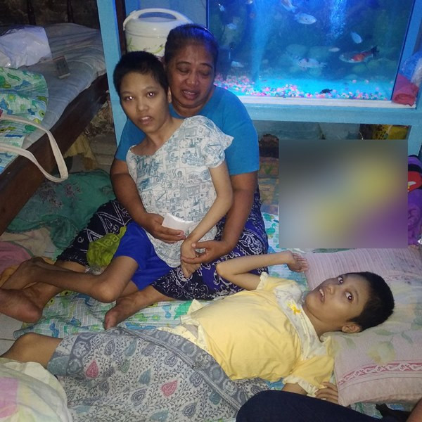 Remaja Kembar Yatim Piatu di Surabaya Lumpuh 15 Tahun