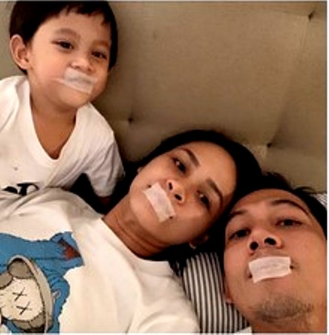 Tren Plester Mulut Saat Tidur