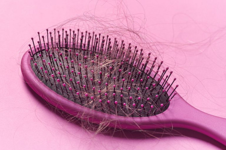 Lima Penyebab Rambut Rontok