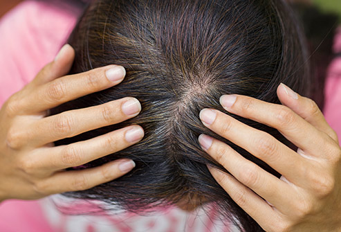 Serba-Serbi Rambut Beruban