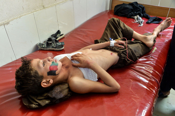 Ratusan Orang Terluka dalam Ledakan Bom di Afghanistan