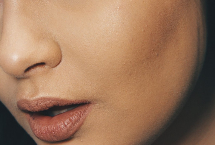 Penyebab Bibir Pecah-pecah dan Cara Mengatasinya