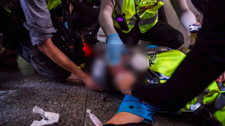 Tertembak, Kondisi Wartawan Indonesia di Hong Kong Makin Stabil