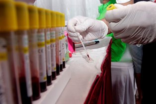 Dinkes Tanah Datar Anjurkan Ibu Hamil Tes HIV