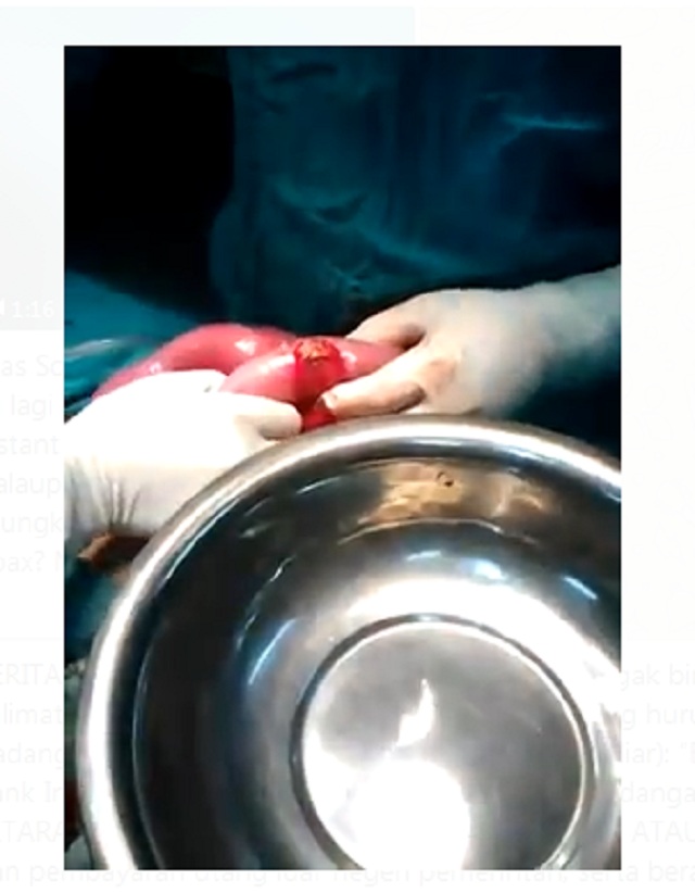 Tangkapan layar pemberitaan palsu dari pesan berantai WhatsApp