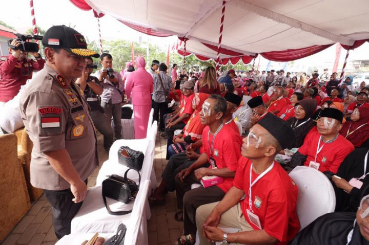 Polda Kepri Operasi Ratusan Penderita Katarak