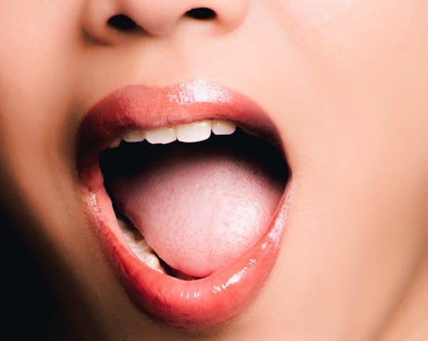 Cara Mengatasi Rasa Sakit saat Sariawan