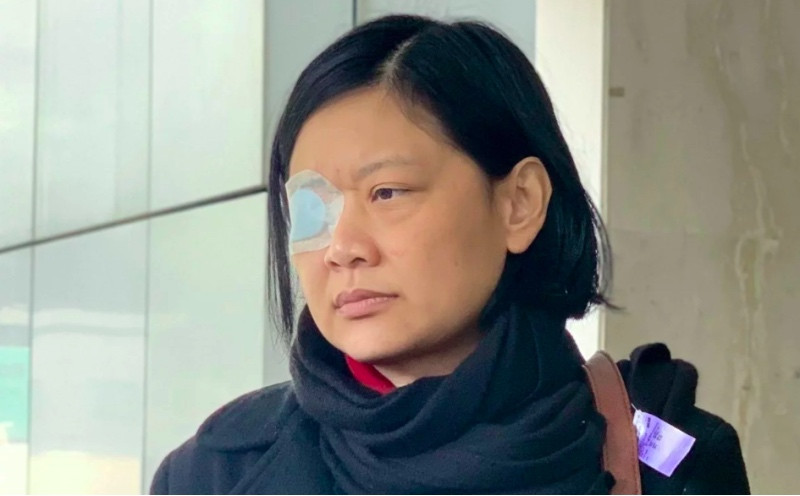 Jurnalis Indonesia Veby Mega Indah terkena tembakan pada bagian mata kanan. Foto: SCMP