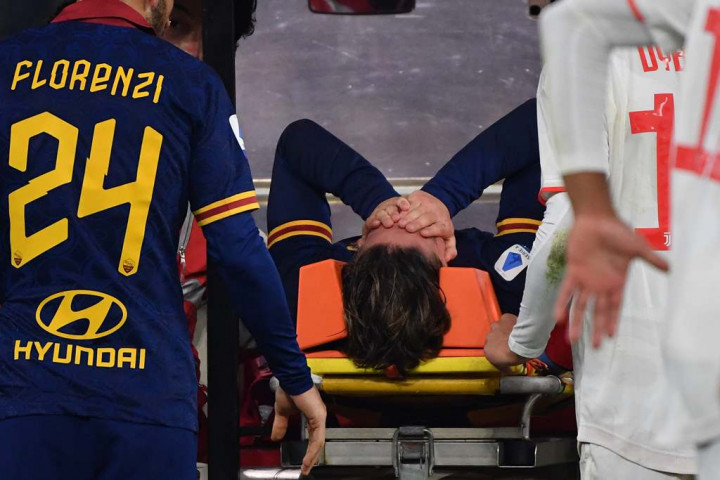 AS Roma Konfirmasi Cedera Nicolo Zaniolo