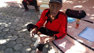 Sumsel Klaim Tingkat Penderita Kusta Masih Rendah