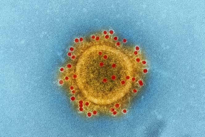 Beberapa jenis bakteri yang bisa menyebabkan meningitis diantaranya, Streptococcus pneumoniae. (Foto: Ilustrasi. Dok. Unsplash.com)