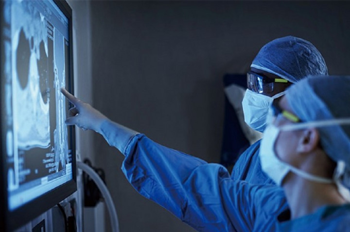 Alibaba Umumkan Ketersediaan Teknologi CT Image Analytics