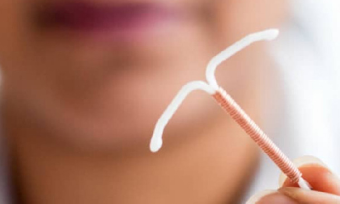 Ini Jawaban Pakar Soal KB Spiral Tembaga yang Berkarat