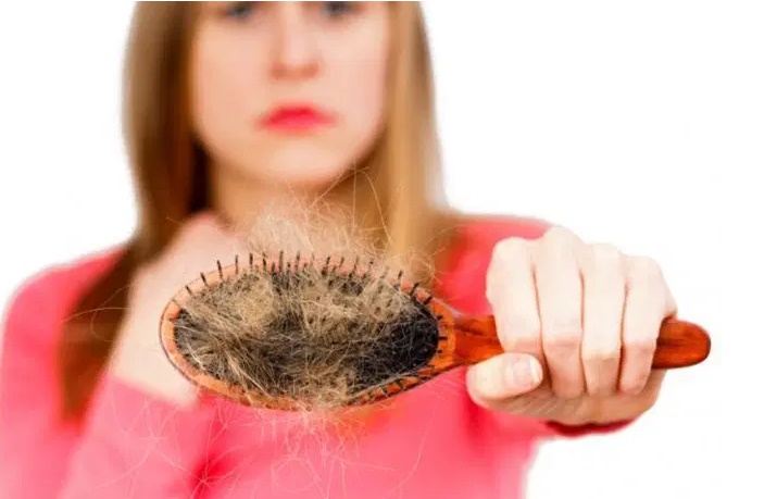 Apakah Pengidap Alopecia Bisa Melakukan Perawatan Rumahan?