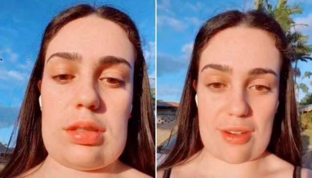 Muka Remaja Ini Jadi Kotak Setelah Ikuti Prosedur Kosmetik