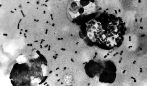 Apa itu Wabah Bubonik yang Ada di Tiongkok?