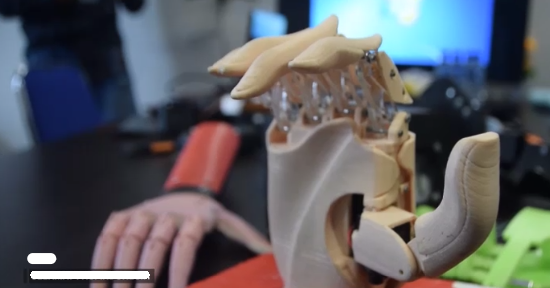 Hebat! UNDIP Ciptakan Robot Tangan Bionik untuk Sahabat Difabel