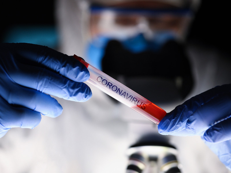 Illustration (Photo:Medcom.id/M Rizal)