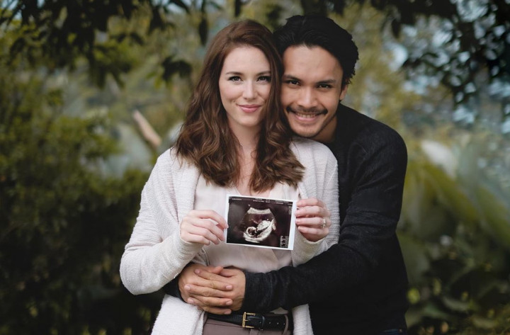 Randy Pangalila Umumkan Kehamilan Istri Bulenya