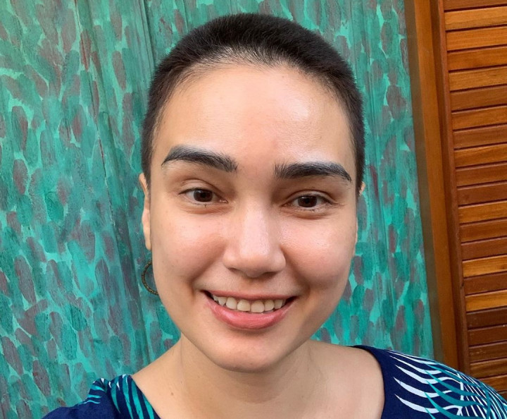 Awal Mula Feby Febiola Terbuka soal Penyakit Kanker