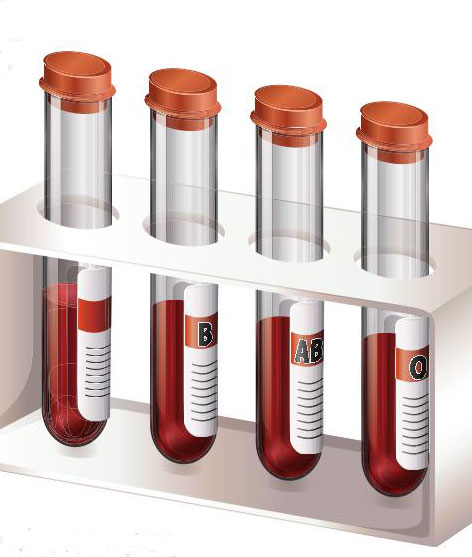 Dibutuhkan 200 Pendonor Plasma Setiap Hari