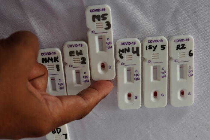 Perusahaan Lokal Bikin Alat Deteksi Covid-19 Pascavaksin