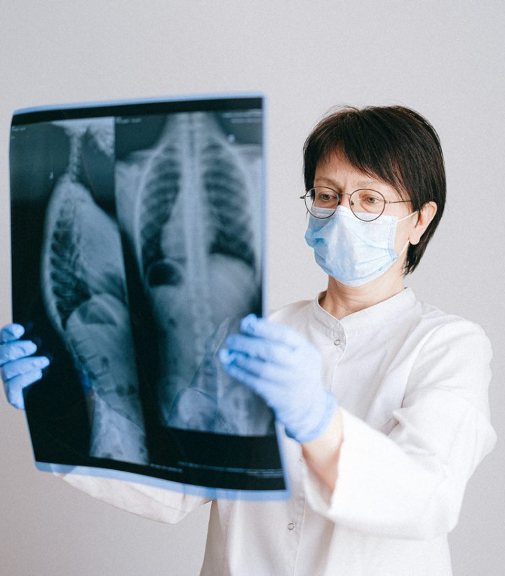 Pentingnya Mengetahui Gejala Kanker Paru dan Pengobatan Dini