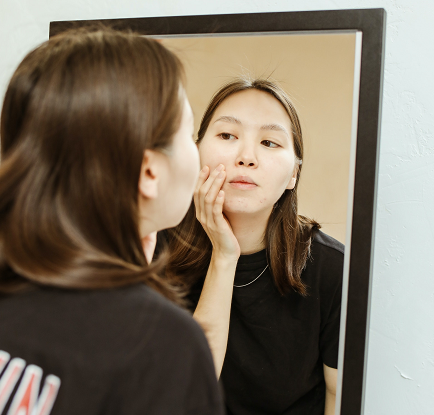 6 Jenis Makanan yang Harus Kamu Hindari untuk Mencegah Jerawat