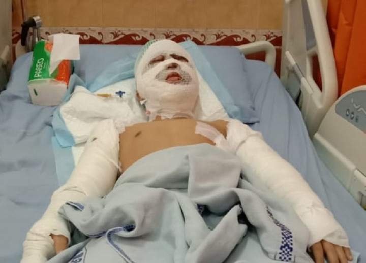 Pemuda yang Disiram Air Keras di Tangerang Telah Menjalani Operasi