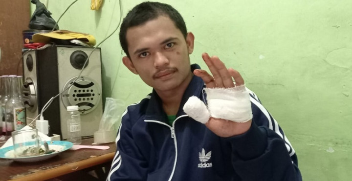Gangster di Cibodas Tangerang Serang Ayah dan Anak