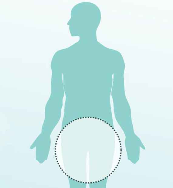 Hipospadia Bisa Dideteksi Sejak Dini