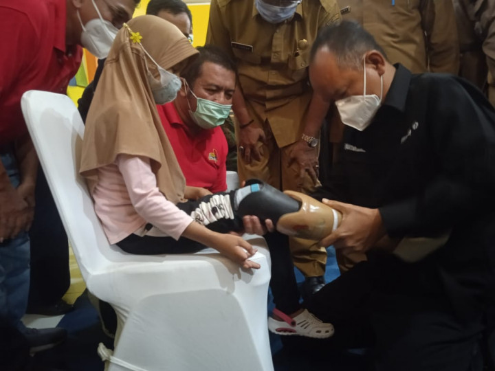 Kick Andy dan Angkasa Pura II Salurkan 40 Kaki Palsu di Aceh