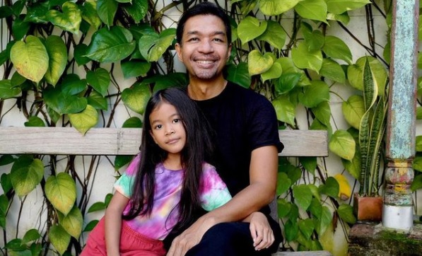 Terungkap, Dimas Djayadiningrat Ternyata Buta Warna