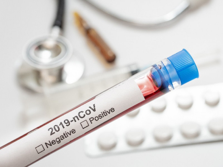 Kimia Farma Bakal Beri Sanksi Tegas Oknum Pemalsu Alat Tes <i>Rapid</i> Antigen